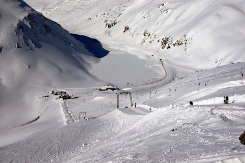 Alpsu
